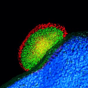 This image shows a Plasmodium parasite (green) being surrounded and attacked by guanylate binding proteins (red), the host’s defense. The host cell nucleus is shown in blue. All of this action happens within the host’s liver cell, and Sam Kurup is trying to determine how the parasite is able to thwart such an attack. (Image courtesy of Kurup Lab)