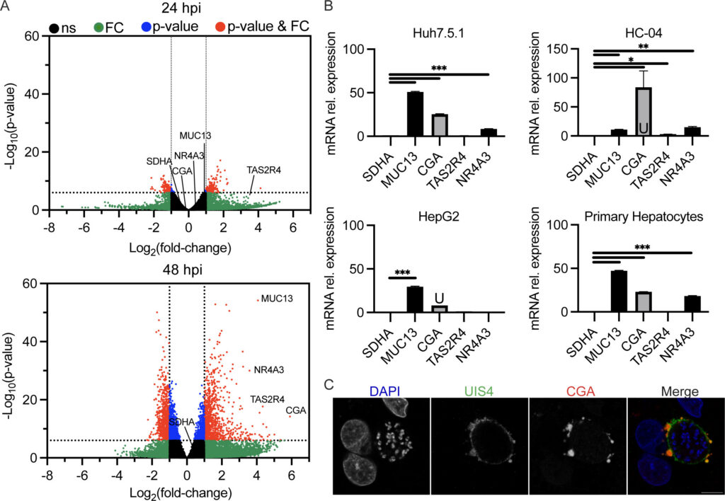 Panel of scientific graphs and images showing gene expression analysis, volcano plots, bar graphs of mRNA levels in various cell types, and fluorescent microscopy images highlighting host protein recruitment and VAMP3 vesicles during the Plasmodium liver stage.